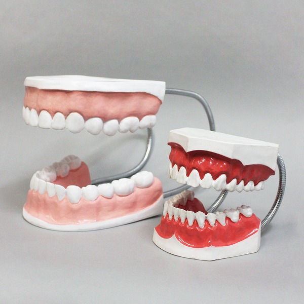 치아모형 대형